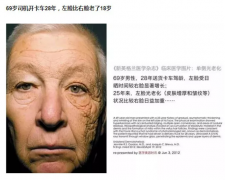 澳洲認(rèn)證防曬霜有哪些品牌(澳洲防曬怎么樣)