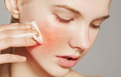 養(yǎng)護敏感肌防曬霜推薦品牌