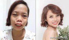 微調(diào)整形要多少錢(現(xiàn)在微整形要多少錢)