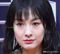 明星做了整形多少錢(藝星整容多少錢)