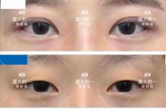 廈門整形大概得多少錢(廈門整形哪家好)