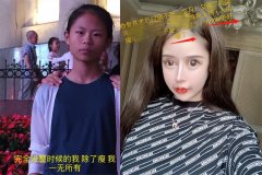 整形美容失敗率多少(整形失敗率有多高)