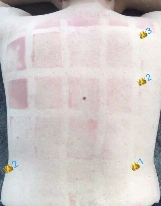 小哥人肉實測15款防曬乳，把自己變成烤肉架，結(jié)果有點搞笑！