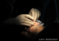 面部整形多少天不腫(整形第幾天腫)