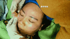 西安學(xué)微整形學(xué)費多少(西安哪里可以學(xué)微整形)