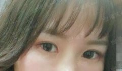 上海整形整鼻子需要多少錢(上海整容鼻子需要多少錢?)