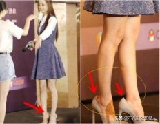 韓國腳趾整形多少錢(excel表格格式錯(cuò)誤如何還原)