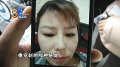 眼睛和鼻子整形多少費用(鼻部整形需要多少費用)