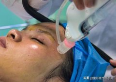 汽車輕微整形多少錢(微型整容要多少錢)