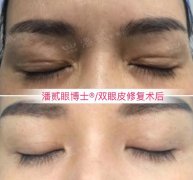 區(qū)整形美容手術多少錢(整形美容手術價格)