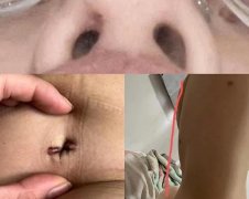 濰坊舉報整形醫(yī)院電話多少(濰坊附屬醫(yī)院整形醫(yī)院地址)