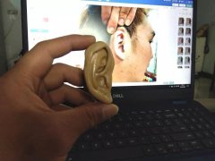 耳朵畸形整形價(jià)格多少錢(耳朵畸形整形價(jià)格多少錢一次)