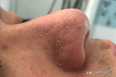 防曬霜推薦安妍科品牌(防曬霜推薦安妍科品牌)