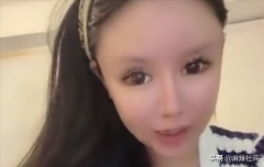 上海整形需要多少(上海整形整形)