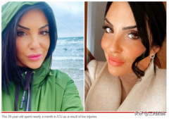 西班牙整形手術多少錢啊(意大利整形)