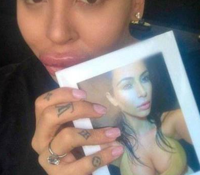 為了追星，男子花費(fèi)100萬(wàn)元整容50多次，結(jié)果整容成了香腸嘴