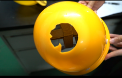 頭部凹陷整形多少錢(山根凹陷整容手術要多少錢)