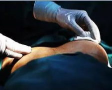 乳腺整形價(jià)格是多少費(fèi)用(乳腺美容手術(shù)多少錢)