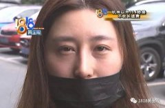 鼻小柱整形要多少錢(做鼻小柱的果怎么樣)