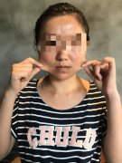 溫州下顎整形醫(yī)院費用多少(溫州整形美容醫(yī)院費用)