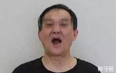 南昌醫(yī)美整形帶牙套多少錢(南昌醫(yī)美整形帶牙套多少錢啊)