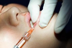 蘭州時光整形隆鼻多少錢(蘭州時光整形割雙眼皮多少錢)