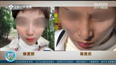 整形醫(yī)院的手術(shù)費(fèi)用多少(整形醫(yī)院需要多少錢)