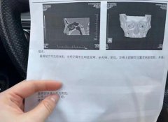 鼻部整形多少錢費用(鼻部整形需要多少錢)