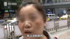激光整形美容多少錢(做激光美容手術(shù)多少錢)