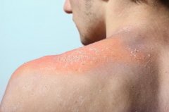 孫紅雷代言的防曬霜品牌(明星代言的防曬霜)