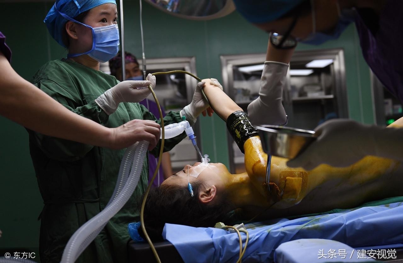 安徽合肥：模特閨蜜同時(shí)做隆胸手術(shù)，手術(shù)僅用了一個(gè)小時(shí)