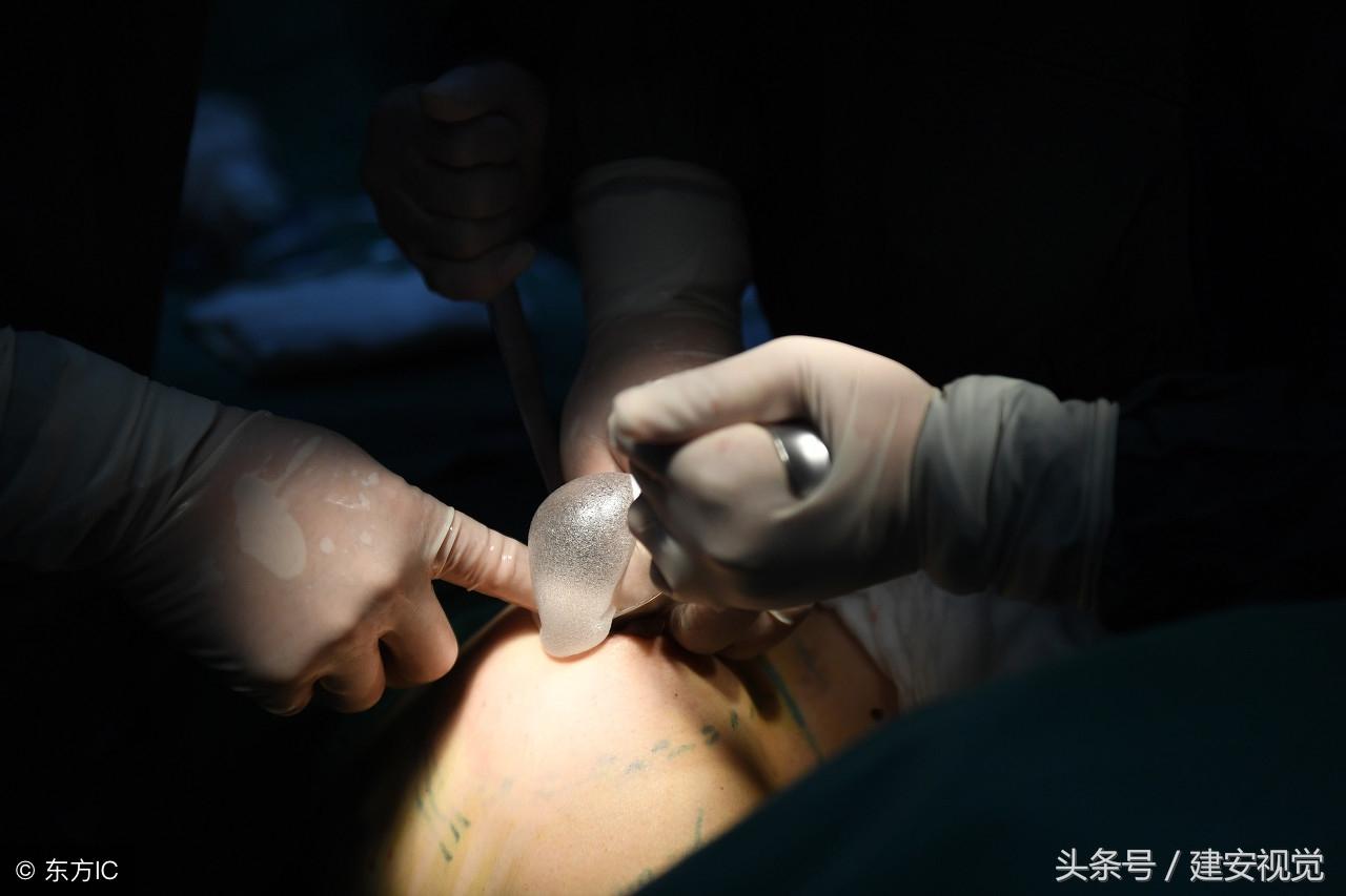 安徽合肥：模特閨蜜同時(shí)做隆胸手術(shù)，手術(shù)僅用了一個(gè)小時(shí)