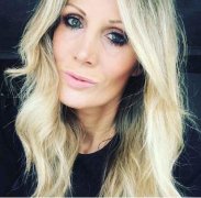 酒窩整形需要多少錢(酒窩整形術(shù)后圖片)