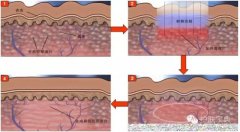 倫琴防曬霜日本哪個(gè)品牌(倫琴防曬霜日本哪個(gè)品牌好用)